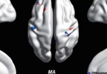 Differences between autistic and non-autistic brains discovered