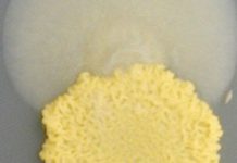 New Mechanism Of Drug Resistance Discovered By Scientists