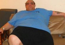 ‘Heaviest’ British man sheds record weight in India!