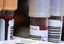 Blood Test May help Identify Those In danger of Psychosis