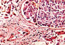 Enzyme-Blocking Molecule Can lead to Growth and development of Cancer-Fighting Wonder Drug