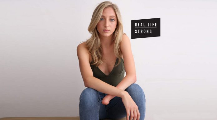 Individuals are Shocked I am a Dancer Because I Was Born Without a Hand