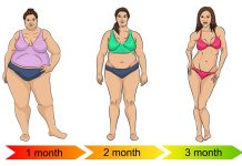 The Effectiveness of Weight Loss Surgery The Effectiveness of Weight Loss Surgery