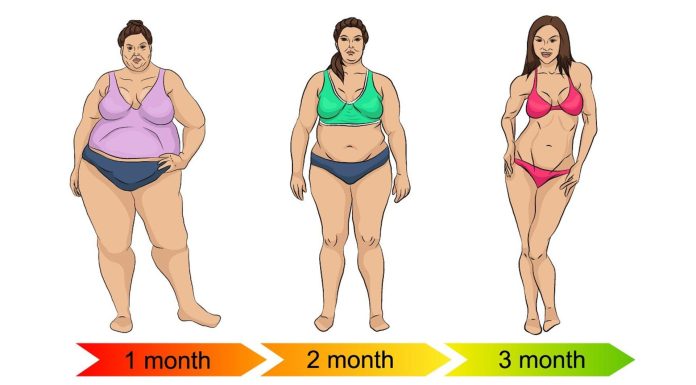 The Effectiveness of Weight Loss Surgery The Effectiveness of Weight Loss Surgery