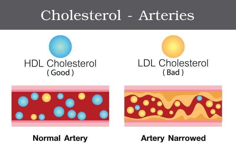 The ‍Role of HDL and LDL in Heart⁢ Health